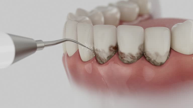Reliable Tooth Extraction contractor in Johnson County County, NE by Dentist Open Now